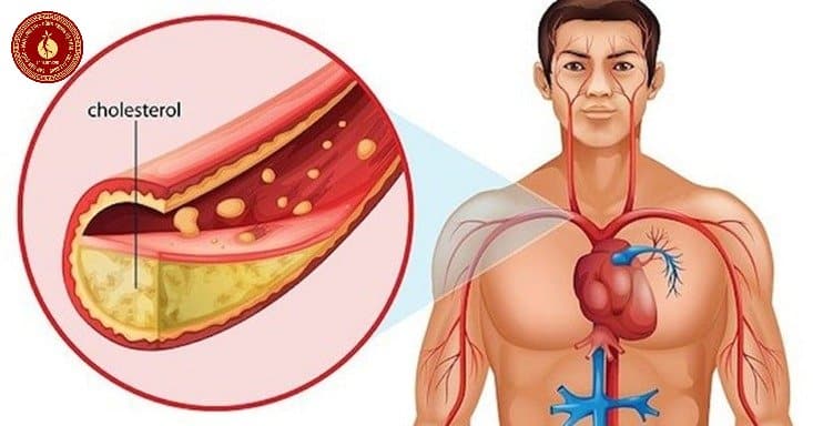 Có nên uống tinh dầu thông đỏ thường xuyên